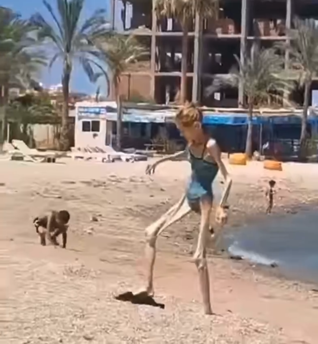 расстройств пищевого поведения