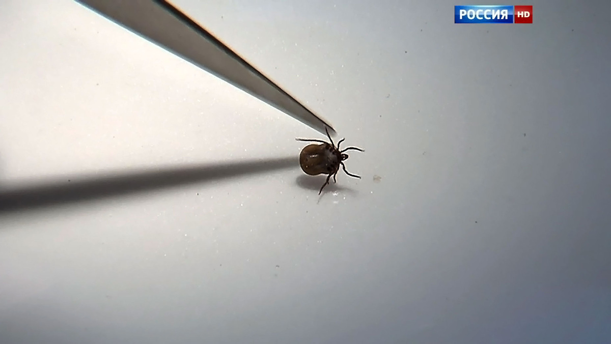    HD клещ клещевой энцефалит