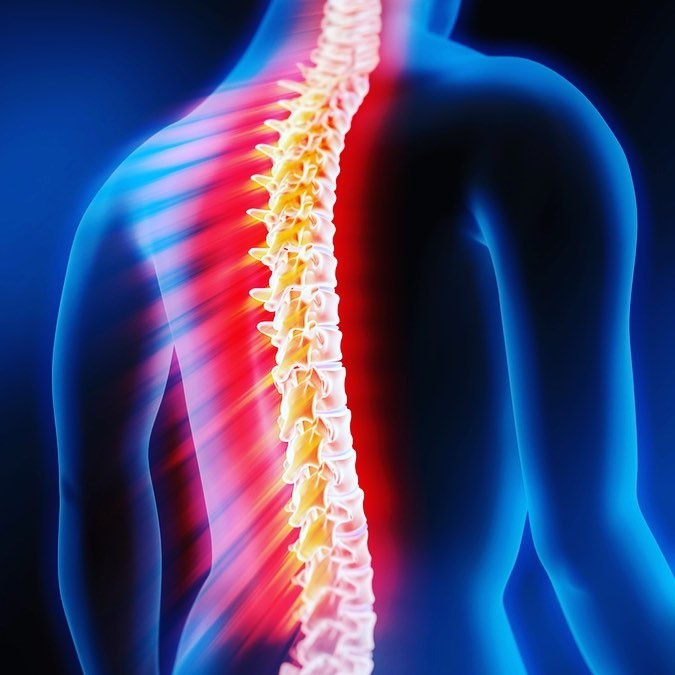 плоскостопие