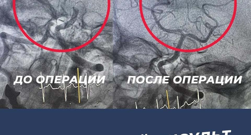    После операции кровоток полностью восстановился / Домодедовская больница