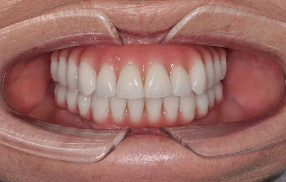 -2-2
