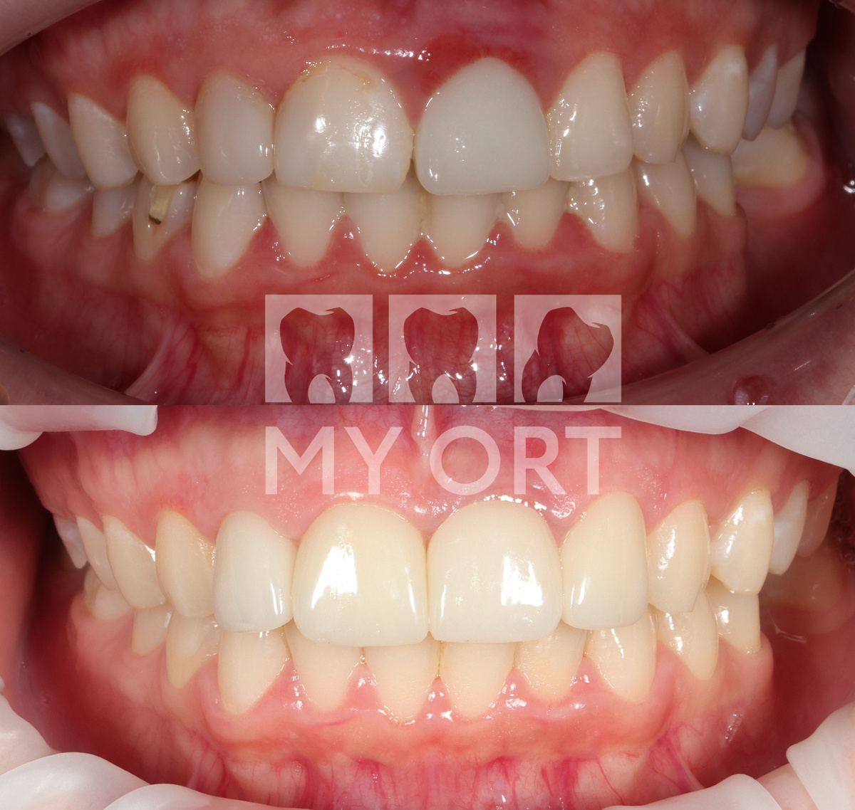 Фото ДО и ПОСЛЕ лечения