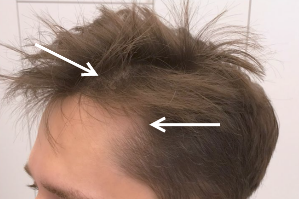 до процедуры