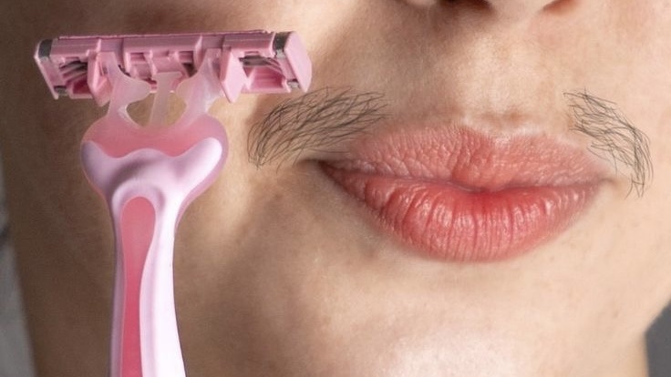 Волосы на лице у женщин — что делать? Доктор Венера Григорян 