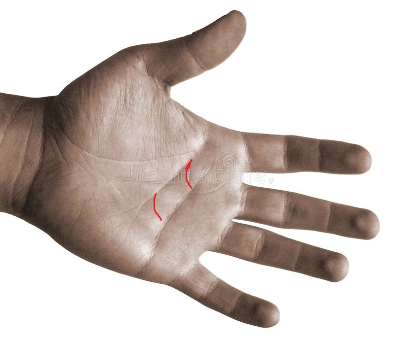 Две линии мести обозначены красным цветом. Шаблон руки - Яндекс картинки, редакция моя. 