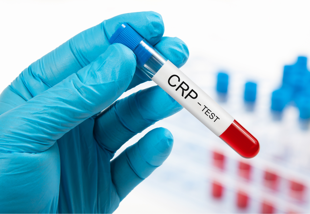 С-реактивный белок: главный сторож вашего организма.
