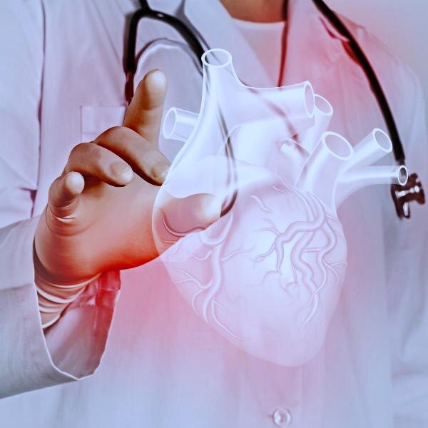 Инфаркт миокарда