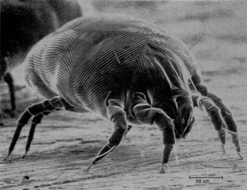 Dermatophagoides pteronyssinus — это микроскопический клещ домашней пыли, который, несмотря на свои невидимые глазу размеры, оказывает огромное влияние на здоровье миллионов людей, являясь мощнейшим бытовым аллергеном. Эти существа не кусаются и не ведут паразитарный образ жизни, однако продукты их жизнедеятельности, накапливающиеся в домашнем текстиле, матрасах и коврах, провоцируют серьезные иммунные ответы: от постоянного насморка и чихания до приступов бронхиальной астмы. Будучи крайне зависимыми от микроклимата, они процветают в теплых и влажных условиях, из-за чего борьба с ними требует не просто регулярной влажной уборки, но и строгого контроля влажности воздуха, а также термической обработки постельного белья. Фото: Pinterest.com