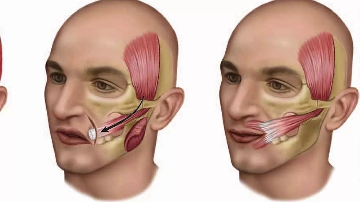 Жевательная и височная мышца