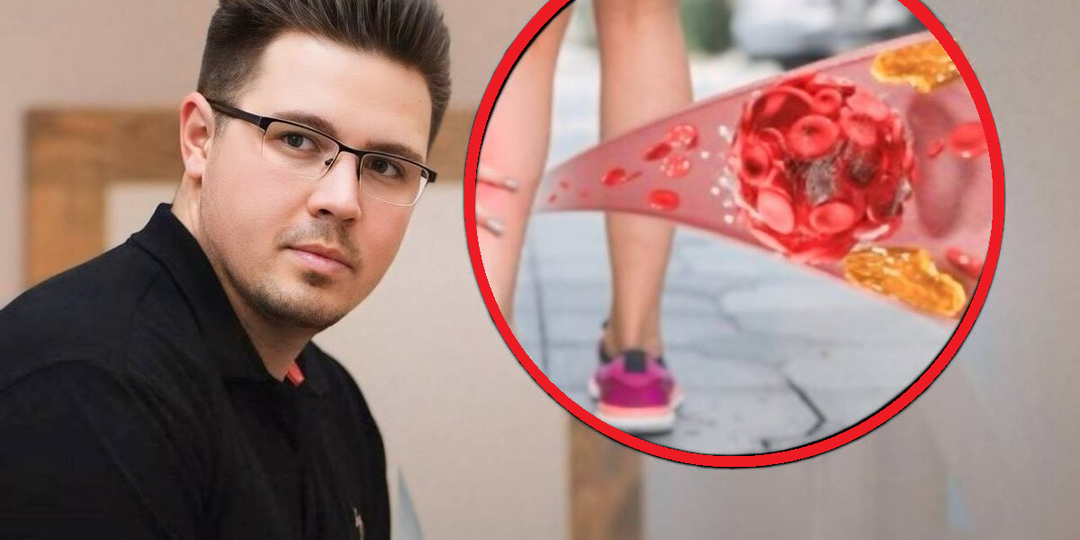 5 признаков забитых сосудов ног, на которые нужно обратить внимание