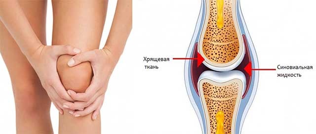 Наглядный пример. Источник изображения: https://clck.ru/3SgE8s