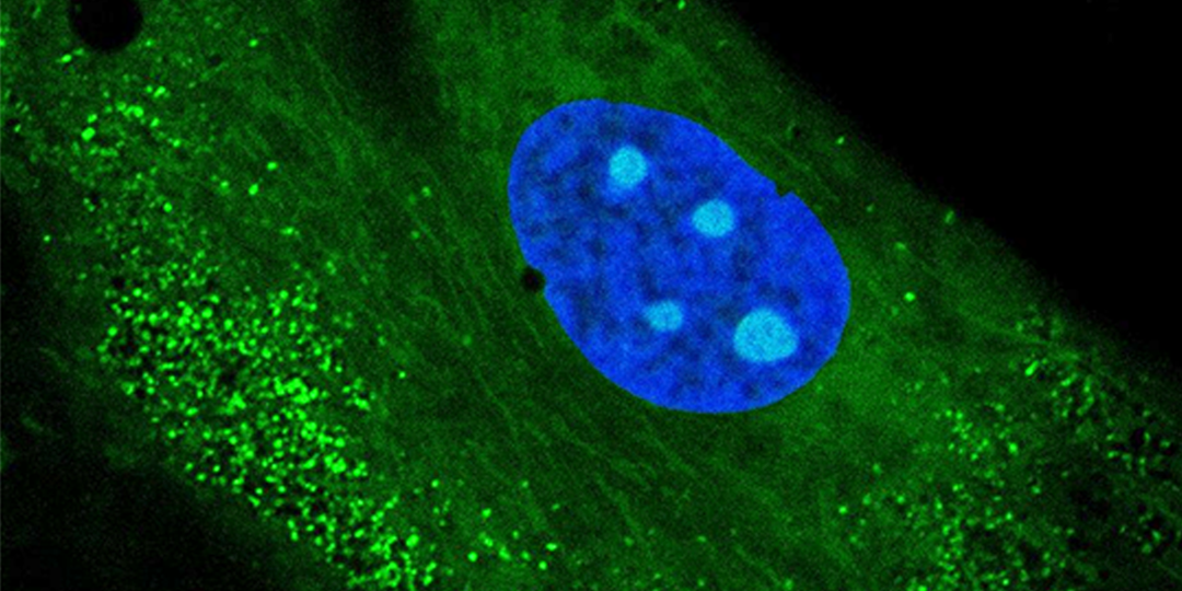Клеточное старение (сенесценция): как модерация питания может замедлить биологические часы