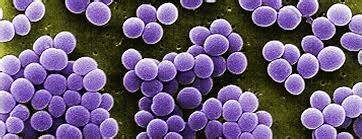 Стафилококк в образце секрета простаты, электронная микроскопия