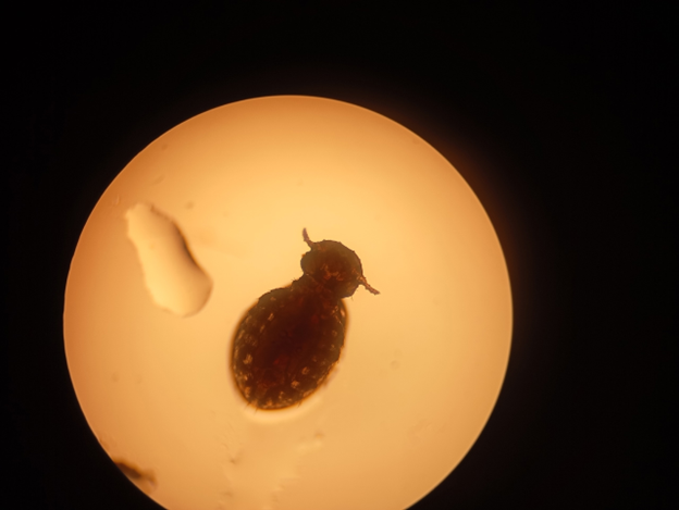 Клещ — фото с микроскопа. Фото предоставлено автором