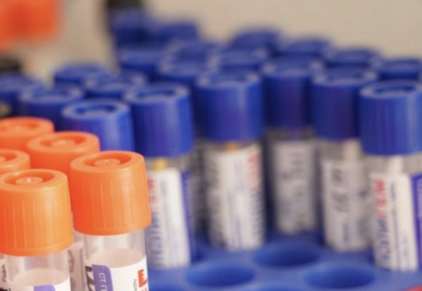 Что делать, чтобы избежать диабета: советы эндокринолога