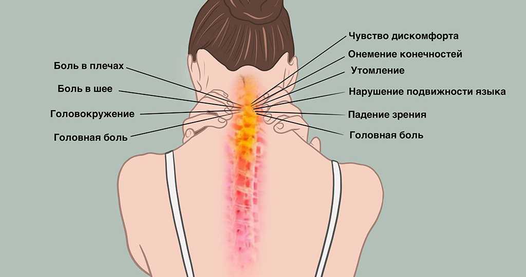 Когда голова становится каменной: 3 простых движения для шеи, которые возвращают подвижность