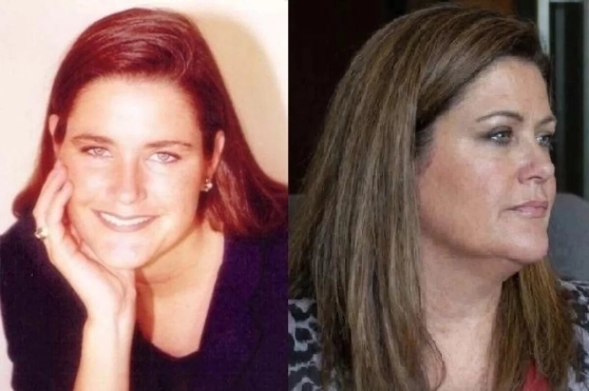    Девушка выжила после того, как ей почти отрезали голову