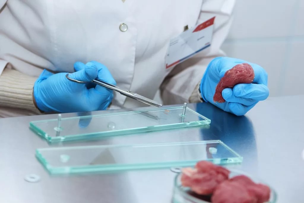 Федеральная служба по надзору в сфере защиты прав потребителей и благополучия человека (Роспотребнадзор) выявила опасную партию колбасы с превышением допустимой концентрации антибиотиков. Продукция поставлялась в детские сады и школы сразу нескольких регионов — Москвы, Подмосковья, Тульской и Калужской областей. Следствие установило, что колбаса произведена на мясокомбинате «Мясной край», который входит в агрохолдинг «АгроПром Групп».