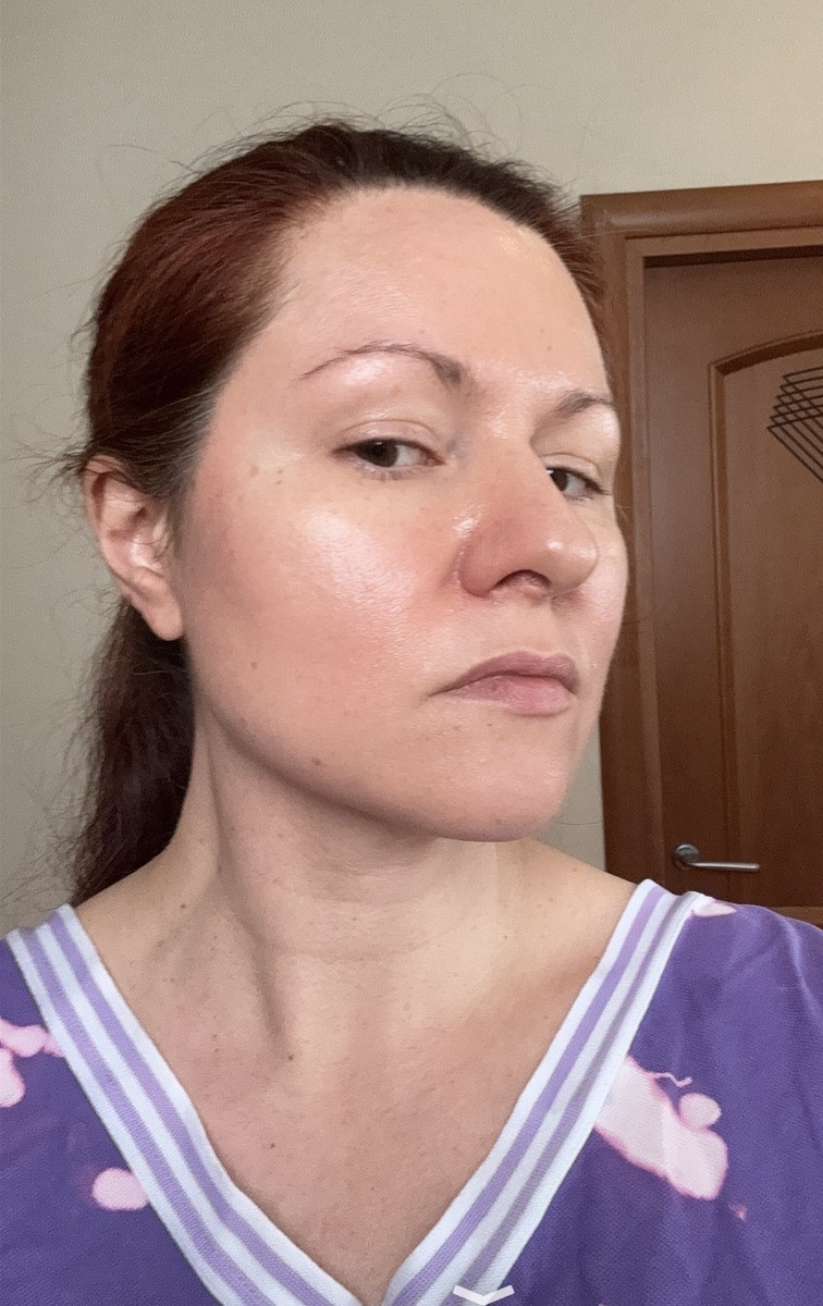 Селфи без обработок, макияжа, прически, зато все хорошо видно. На лице только уход и SPF