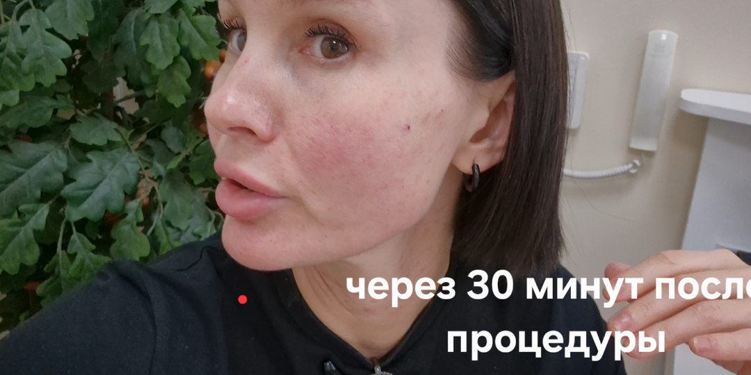 Плазмотерапия