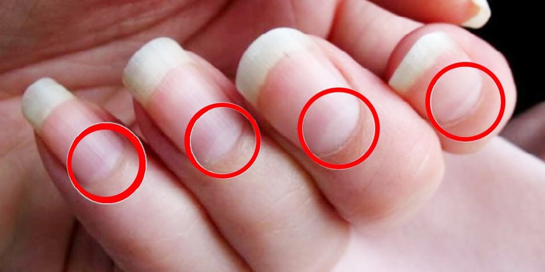 Ногти изменились — какие процессы могут стоять за этим