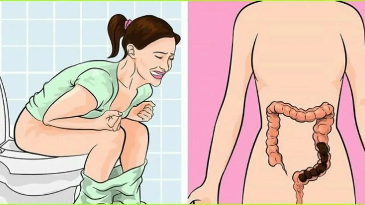 На самом деле очень опасная проблема. Источник изображения: https://clck.ru/3ShS4c