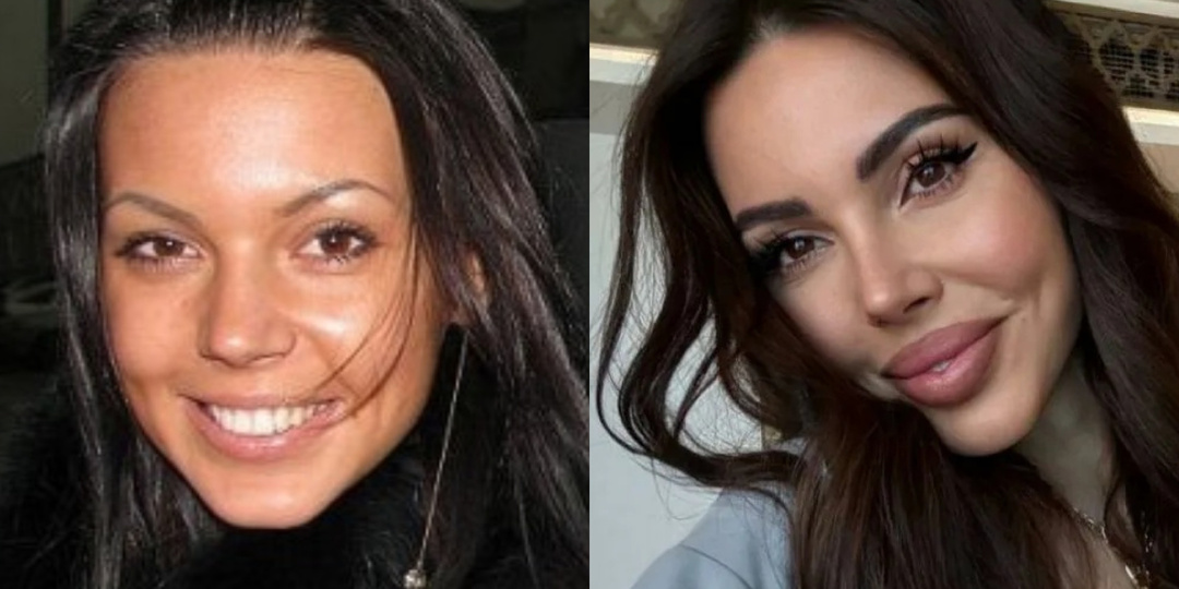 Живые люди или красивые куклы: 9 знаменитостей, изменивших внешность с помощью пластики