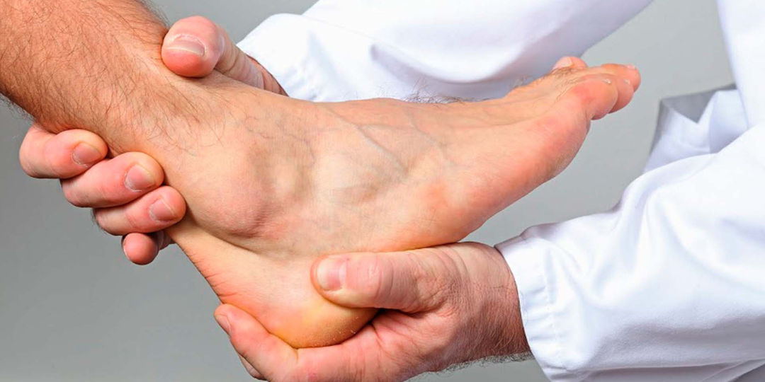 Артроз голеностопного сустава: последствия травм и возрастные изменения. Реабилитация