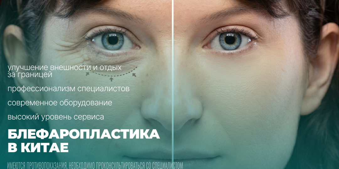 «Поднимите мне веки»: вся правда о блефаропластике в Хэйхэ, ценах и результатах
