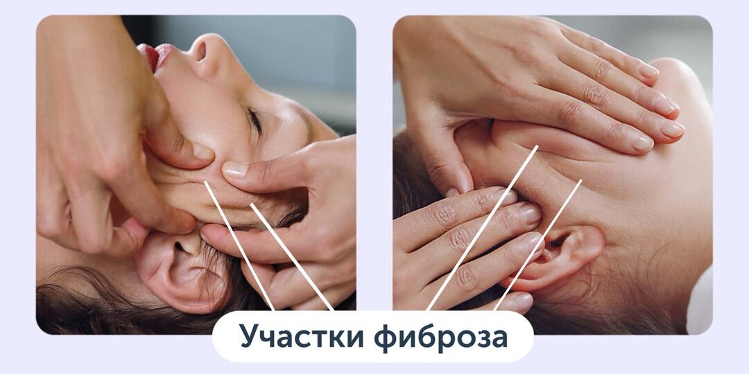 Невидимый враг молодости лица
