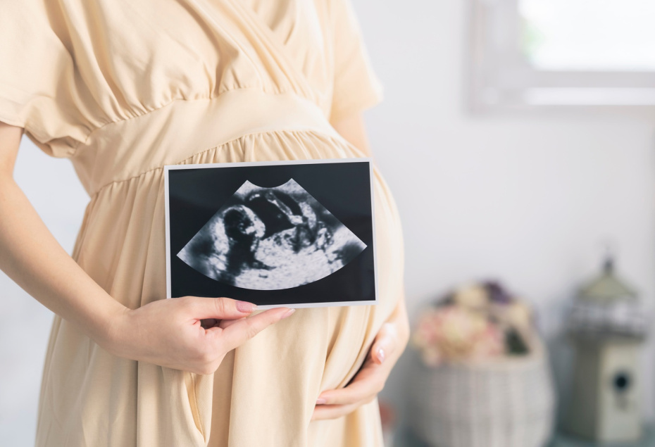    Shutterstock/FOTODOM