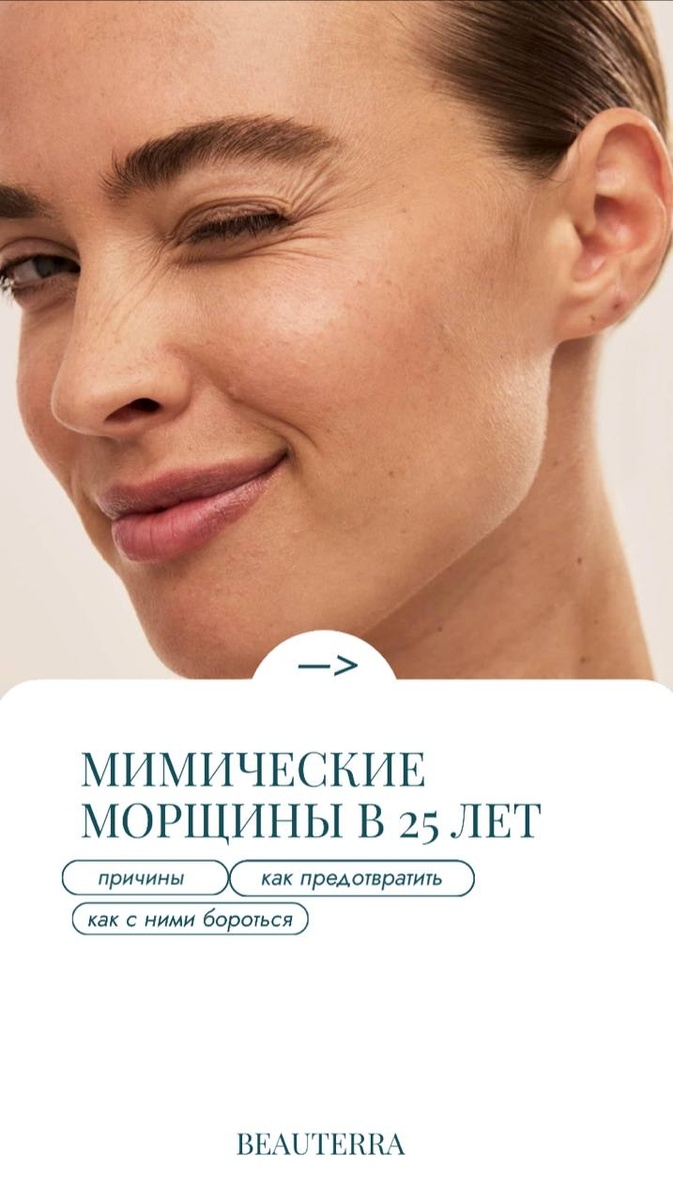 Мимические морщины - как бороться? Что делать? Отвечаем совместно с косметологами клиники БЬЮТЕРРА