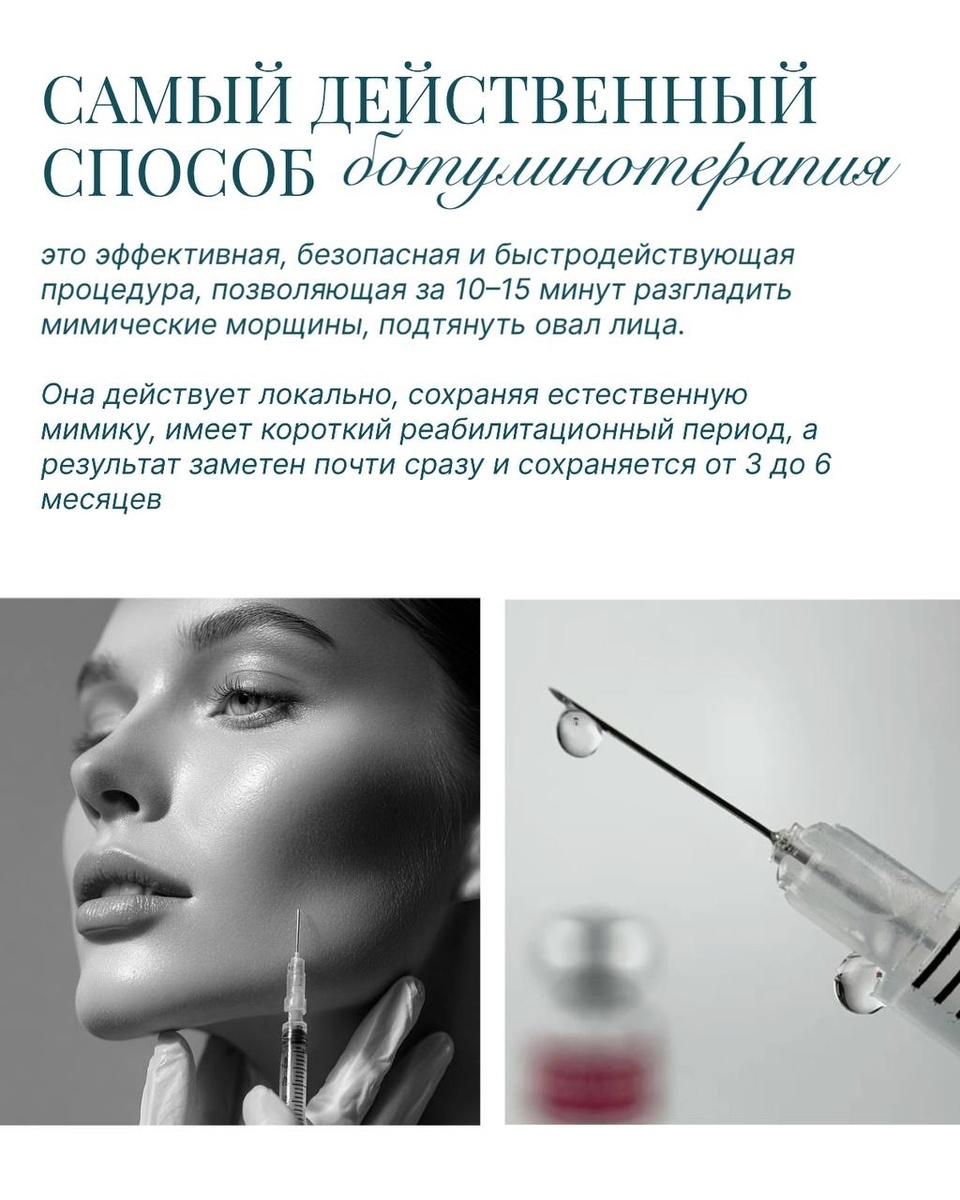 Ботулинотерапия (ботокс) в клинике БЬЮТЕРРА, процедура мягко расслабляет активные мышцы