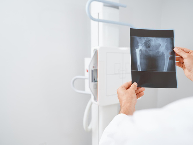 В Нижегородской области ищут инвестора для производства рентгеновских трубок за 4 млрд