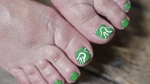 Сахарный диабет второго типа: 3 ранних признака, которые не замечают женщины 50 лет