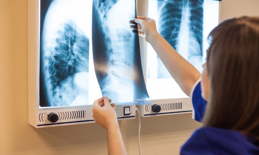 В Минске искусственный интеллект может стать цифровым ассистентом врача-рентгенолога