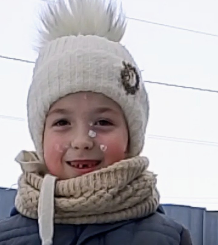 Белые бляшки на улыбающейся беззубой мордахе Катюни - не что иное как обработанные пузырьки ветрянки