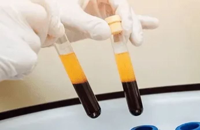 Желтая сверху - это плазма, темно-красное внизу - эритроциты.