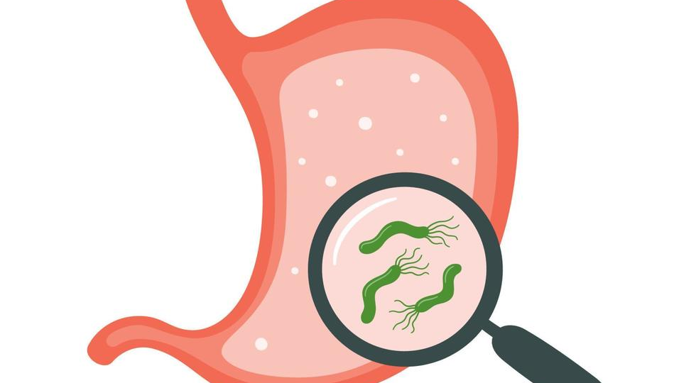 Хеликобактер: как помочь пациенту, когда стандартные схемы даются тяжело