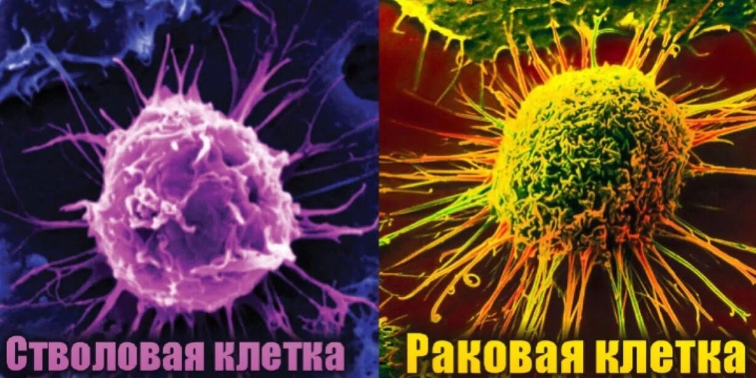 Почему рак возвращается даже после успешного лечения