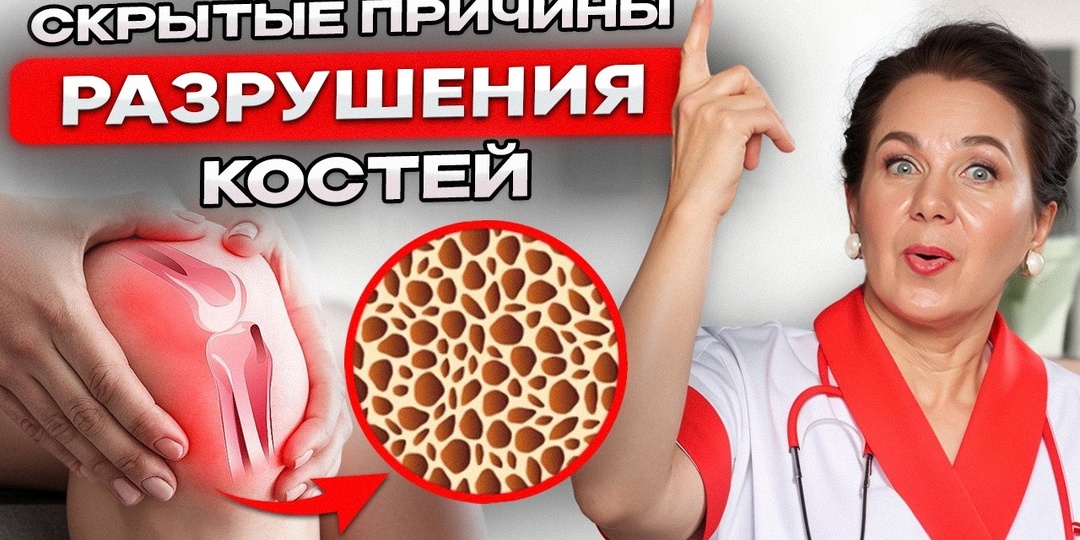 Как снизить риск остеопороза если вам уже за 50