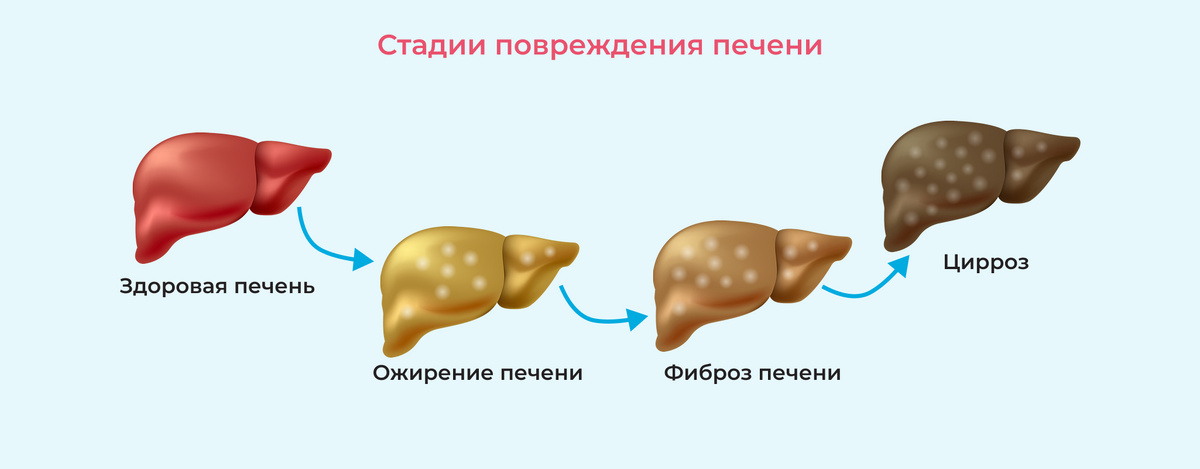Наглядный пример. Источник изображения: https://clck.ru/3SiUea