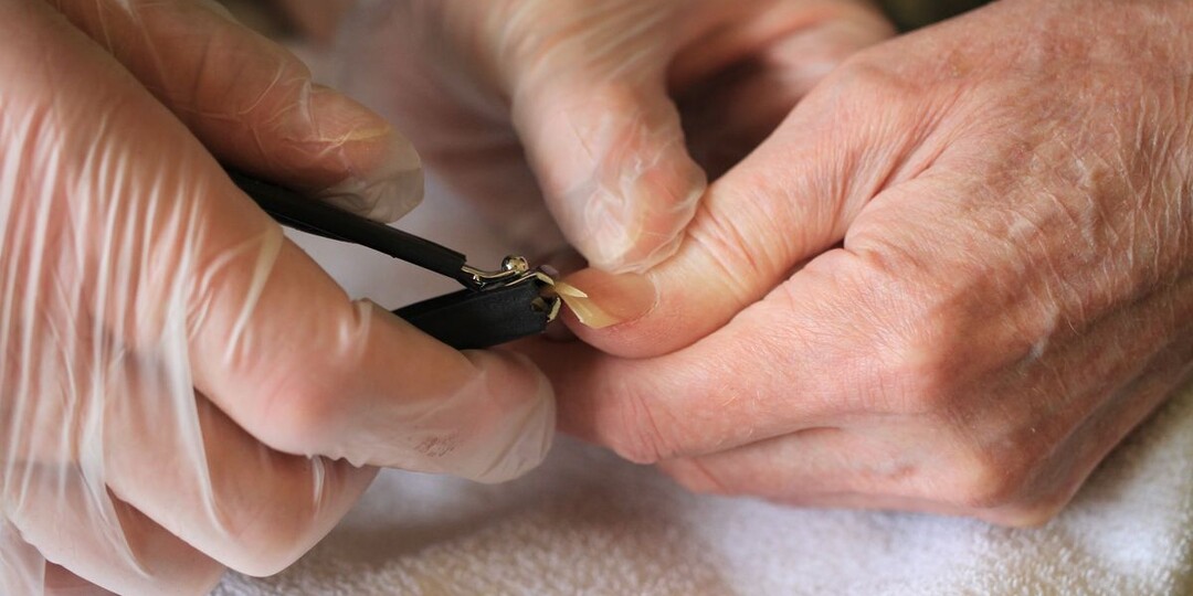 Почему синеют ногти? Врач назвала возможные причины