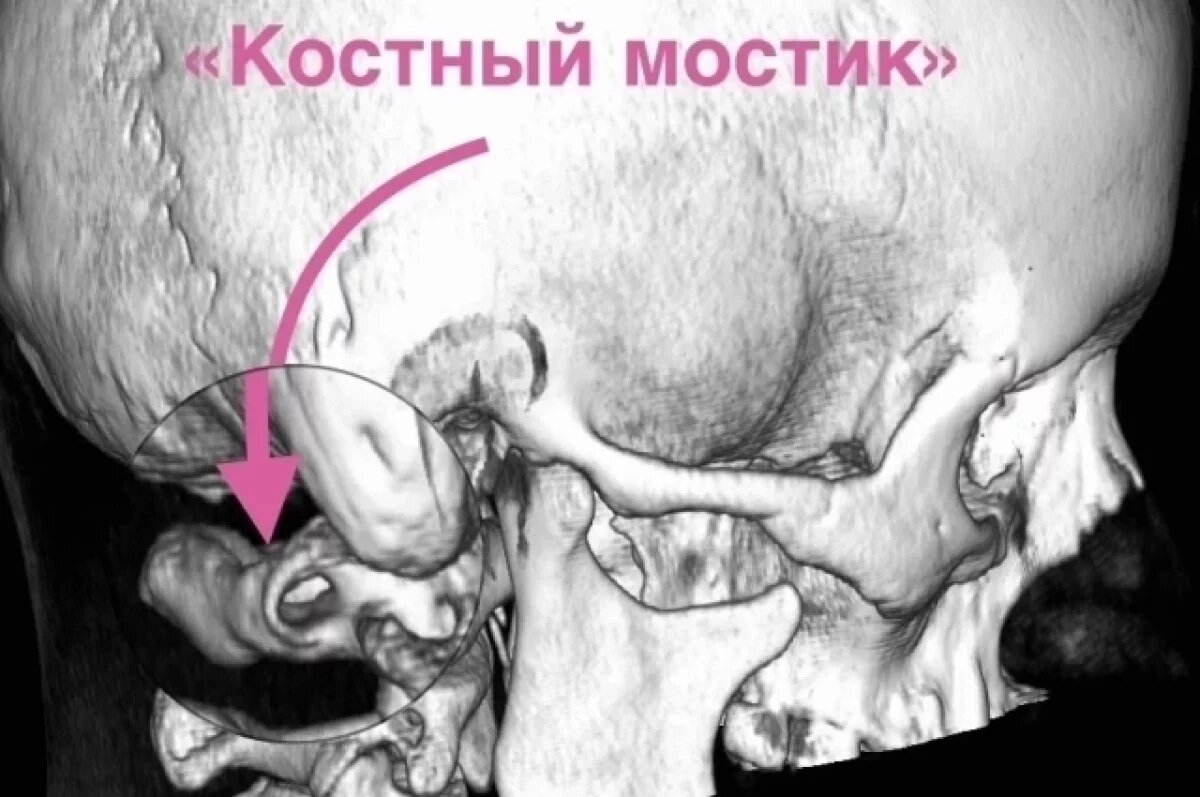    Воронежские врачи избавили женщину от головных болей, мучивших её 15 лет