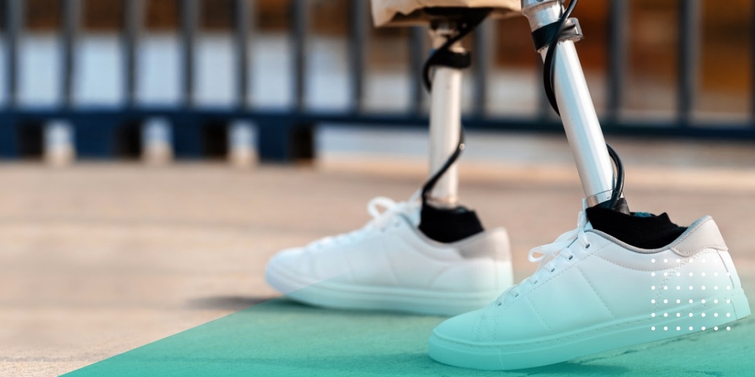 Жизнь после ампутации: что на самом деле происходит в реабилитационном центре