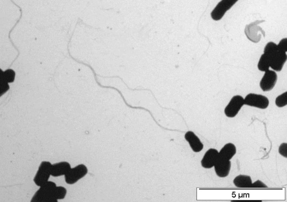    Клетки бактерии Exiguobacterium sibiricum / © BMC Genomics