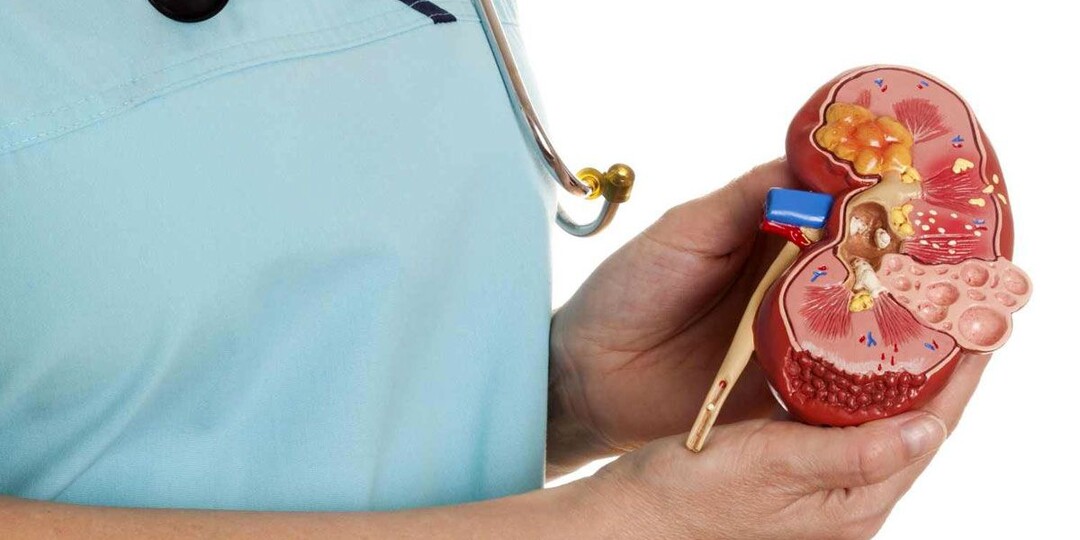 Киста в почке: нашли на УЗИ - что теперь? Спокойно разбираемся, что это и как жить дальше