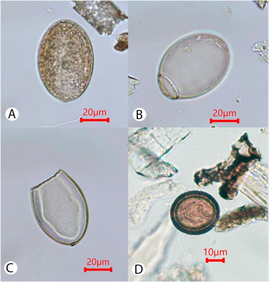    Яйца кишечных паразитов, обнаруженные при исследовании фекалий собак из Жоховского участка. А — целое яйцо Dibothriocephalus sp., В — яйцо Dibothriocephalus sp. с отделенной крышечкой, С — яйцо Dibothriocephalus sp. без крышечки, Г — яйцо Taeniidae (цепень).