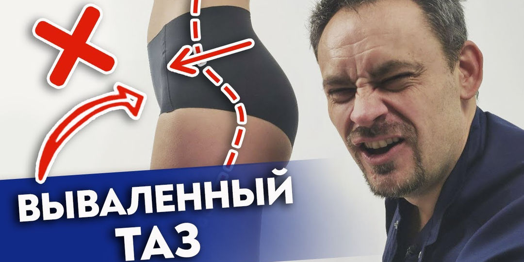 У 90% людей вываленный таз! Выпрямление поясничного лордоза