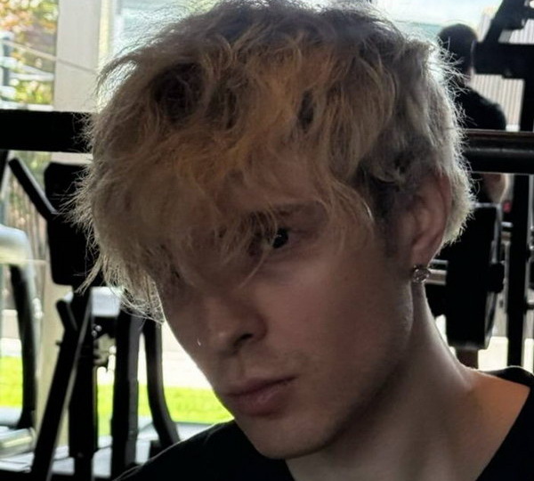 11-летняя девочка получила травму в давке на концерте Егора Крида